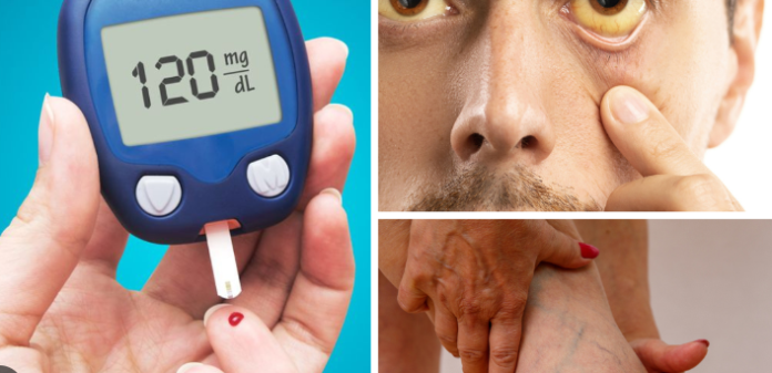 Diabetes Symptoms